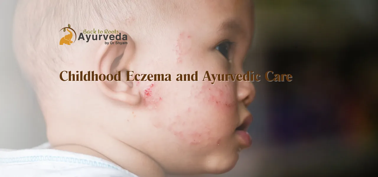 Understanding Childhood Eczema and Ayurvedic Care